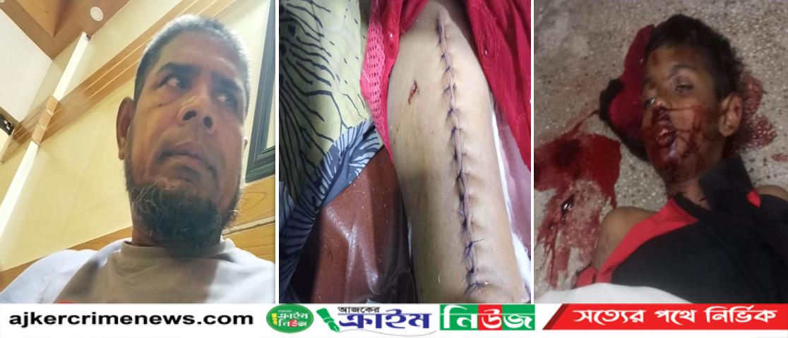 বরিশালে আনসার বাহিনীর গাড়ির ধাক্কায় শিশু নিহত, আহত মা — তিন মাসেও বিচার না পাওয়ার অভিযোগ ভুক্তভোগীদের